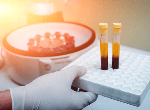 Care Fertility’s platelet rich plasma (PRP) clinical trial has it’s first pregnancy